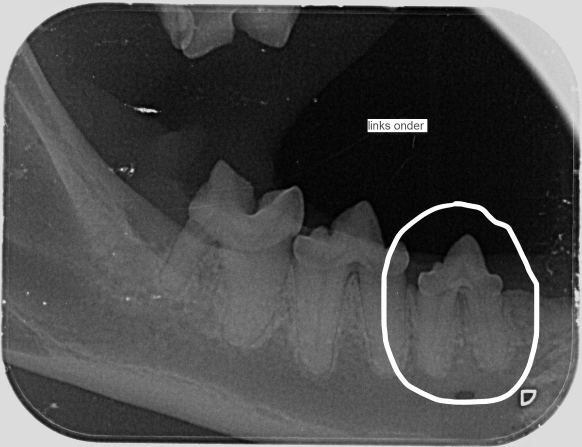Dentale-RX-zonder-resorptie-1200x922